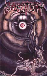 Neurotomy : In Extremis